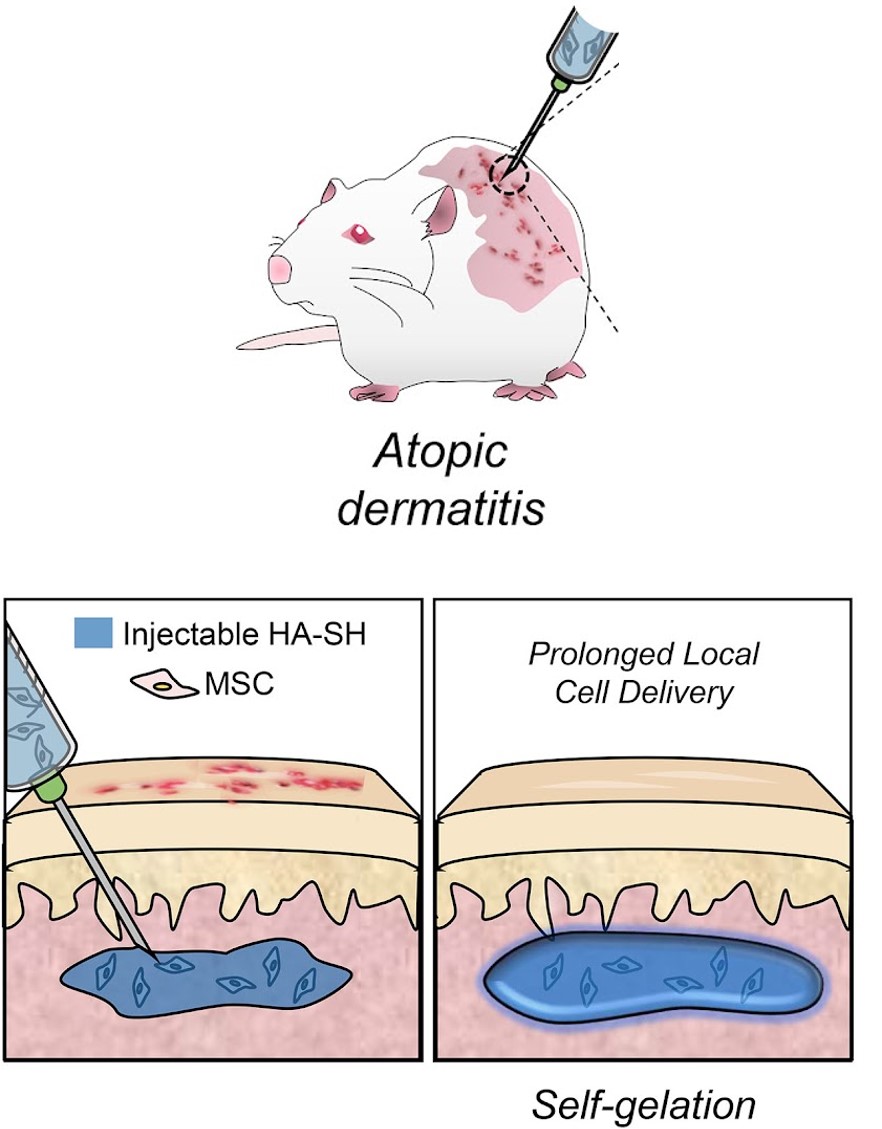 [고분자약물전달실험실] 체내 주입형 하이드로젤 기반 중간엽 줄기세포 주사제 개발