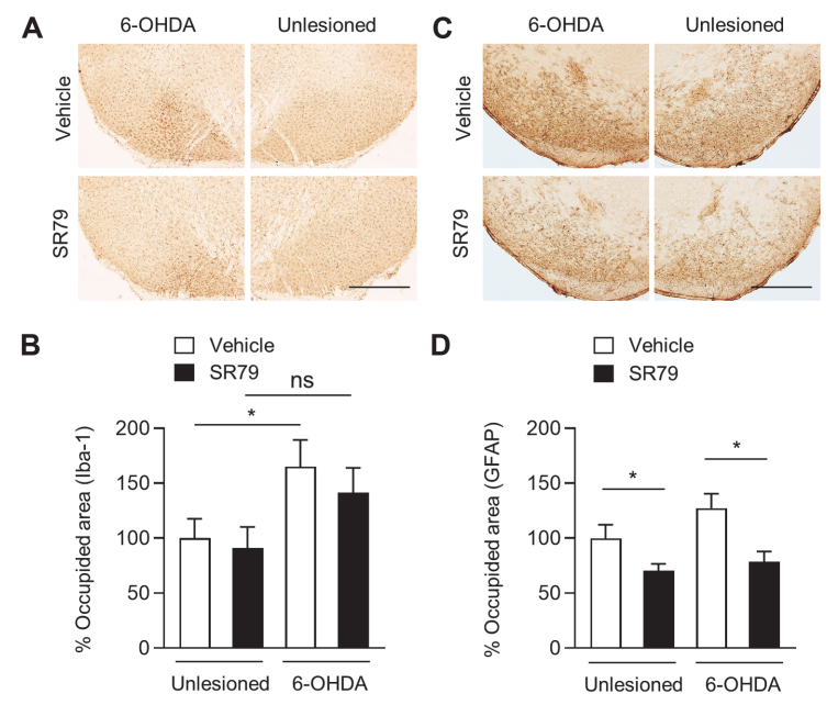 [분자생물실험실] 새로운 파킨슨질환 치료제 개발