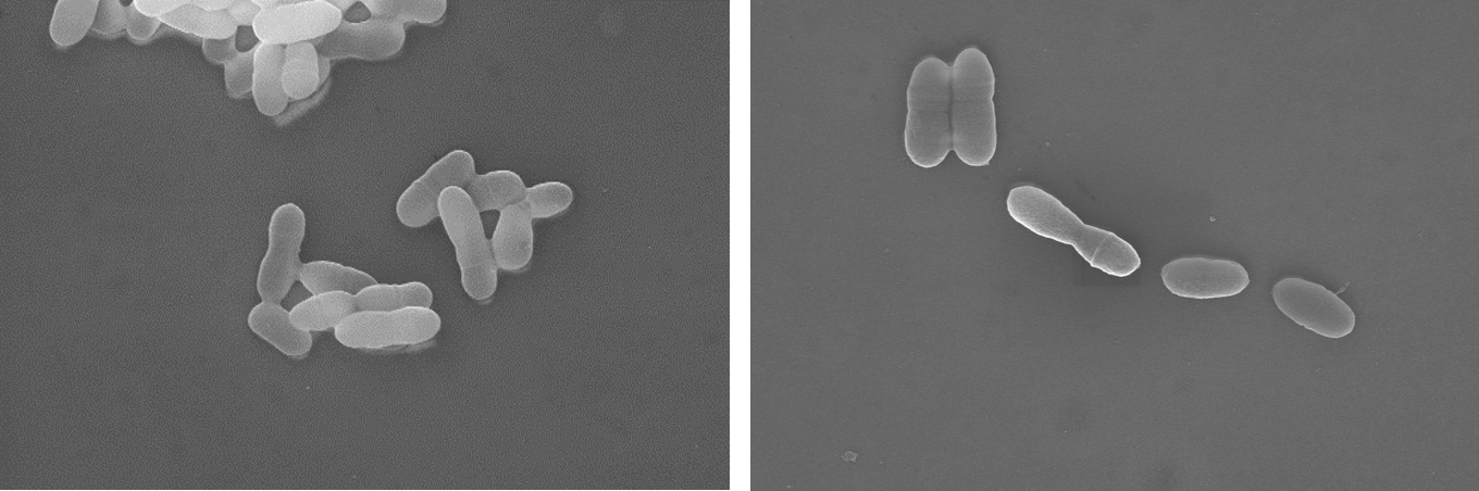 Fig. 1. Scanning electron microscopy (SEM) images comparing the phenotypes of Streptococcus mutans wild-type and persister cells